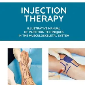 Injection therapy. Illustrative manual of injection techniques in the musculoskeletal system. Ediz. illustrata Offerta Lampo