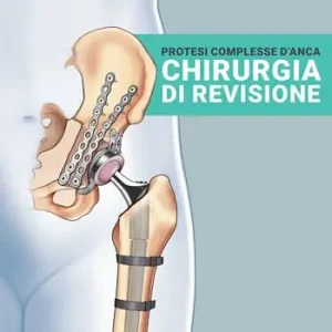 Offerta Lampo Protesi complesse d‘anca. Chirurgia di revisione. Ediz. illustrata