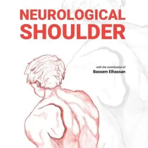Neurological shoulder Popolare