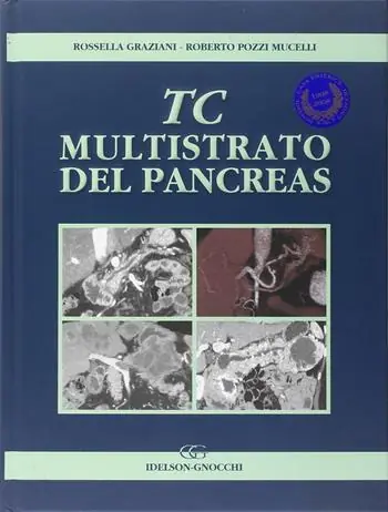 Spedito Oggi TC multistrato del pancreas