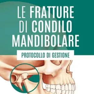 Offerta Le fratture di condilo mandibolare. Protocollo di gestione