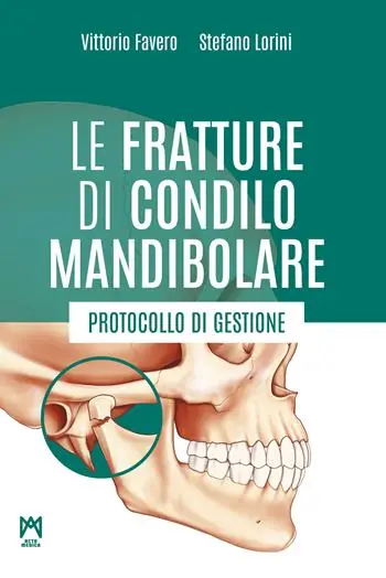 Offerta Le fratture di condilo mandibolare. Protocollo di gestione